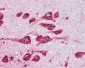 MAOB / Monoamine Oxidase B Antibody (Internal)